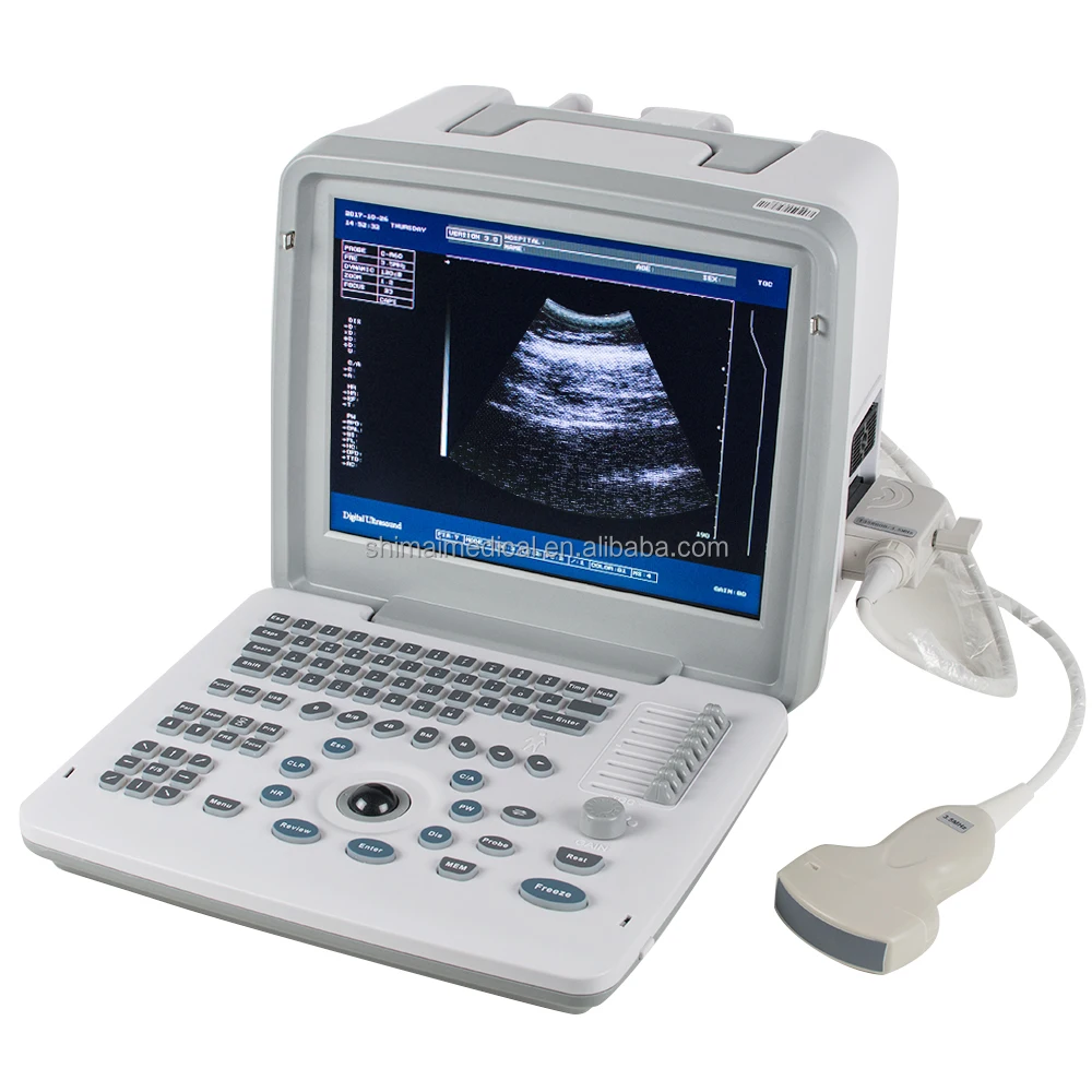 

Cheap Ultrasound Scanner Portable Black White Ultrasound Machine