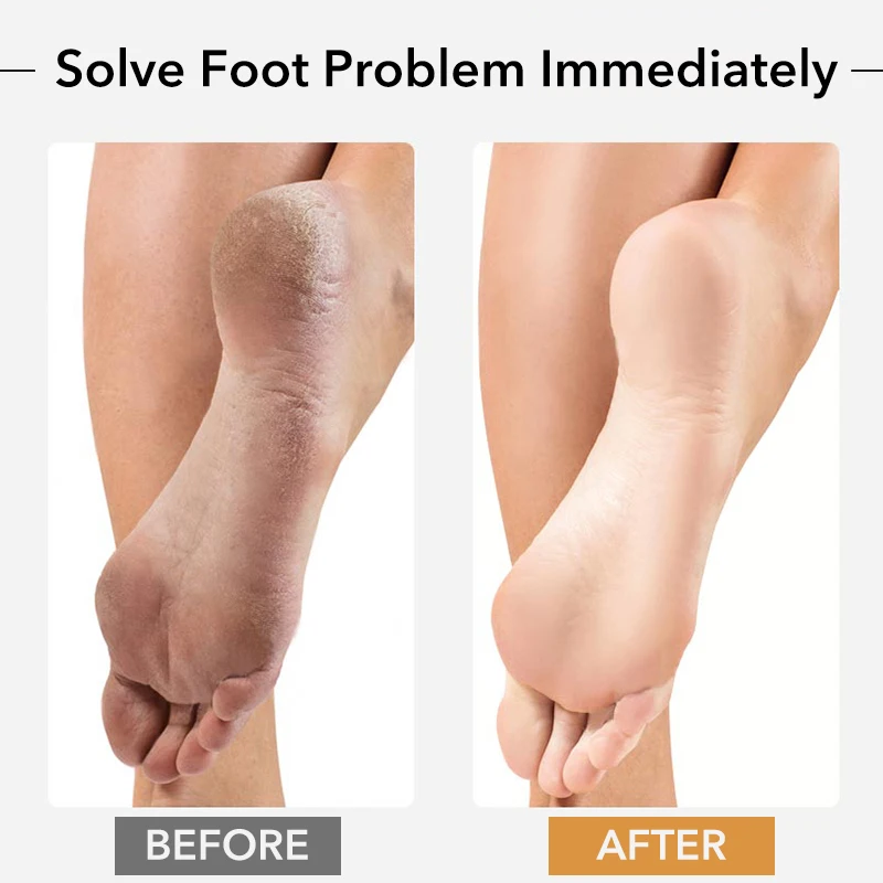 Foot File Foot Care Tool Foot Exfoliating Scrubber Foot Exfoliating File 1PCS Professional Pedicure Rasp Tool for Dead Skin Crack Heels Beech Wood Foot File Rasp Callus Remover Foot Scrubber