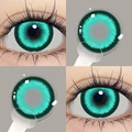 HBC 14.2mm