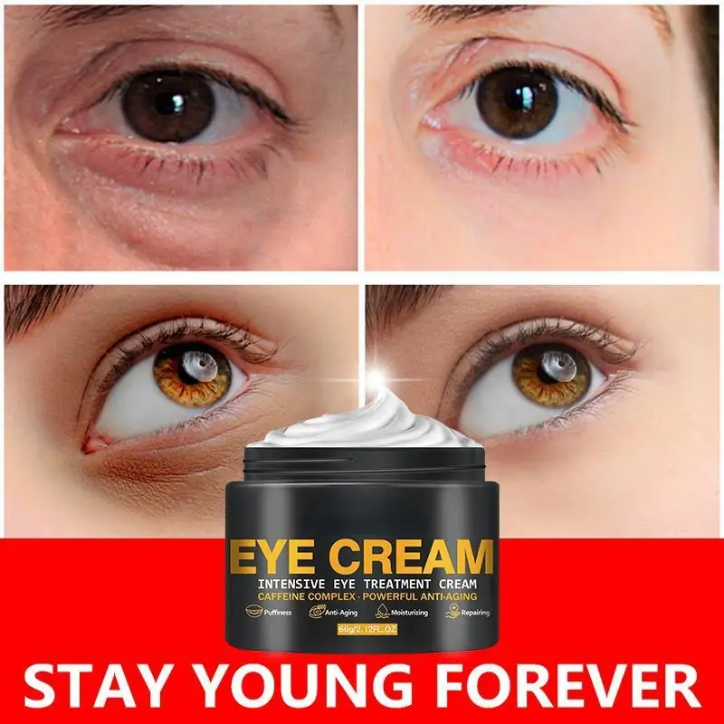 Anti-aging Firming Eye Cream Remove Dark Circles Eye Bags Fat Granule Anti-wrinkle Firming