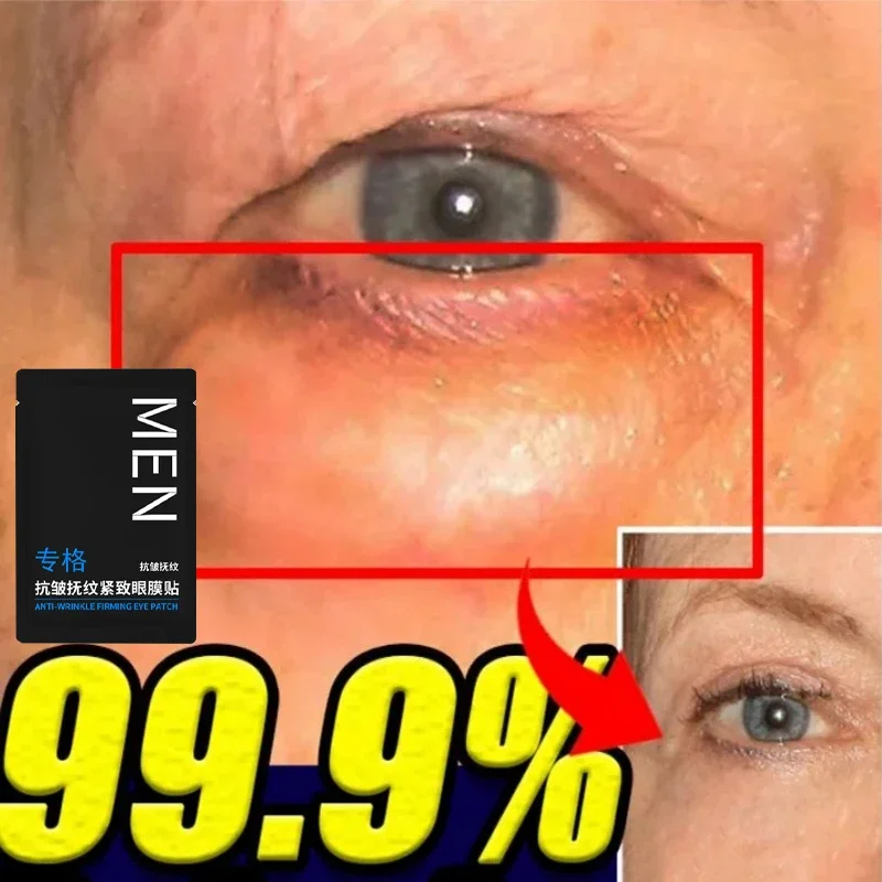 Eyes Bag Remove Collagen Eye Patch Fade Fine Line Dark Circles Fat Particles Moisturizing Anti-Puffiness Korea Eye Care