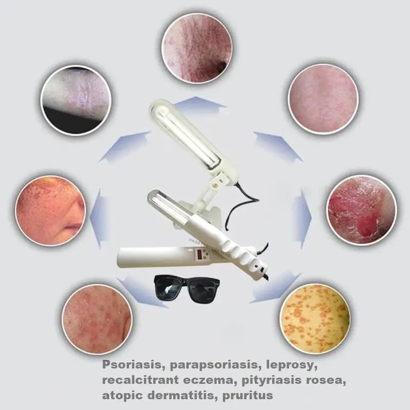 UV 311nm Ultraviolet Phototherapy Device Uses Philips Lamp UVB To Treat Vitiligo Psoriasis White Spots And Skin Diseases uv phototherapy lamp