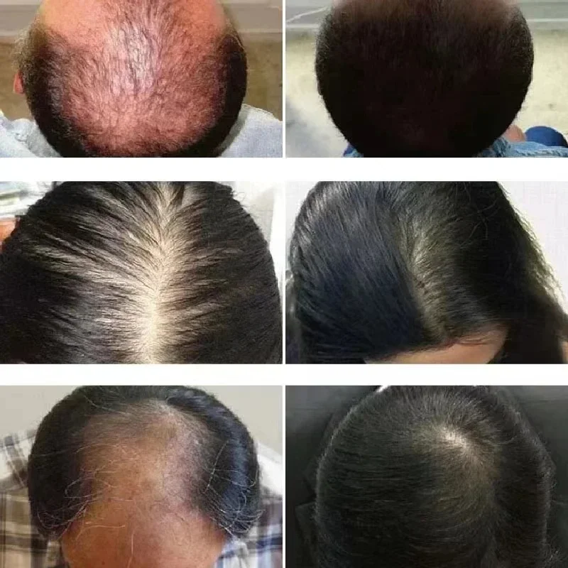 98% of buyers buy again, have more and more hair