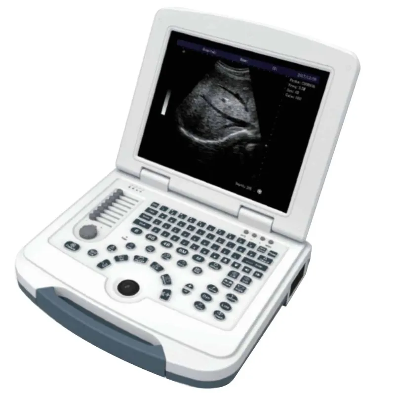 

Laptop Portable Color Dopler Ultrasound Machine Full Digital B/W Scanner for human With convex array probe