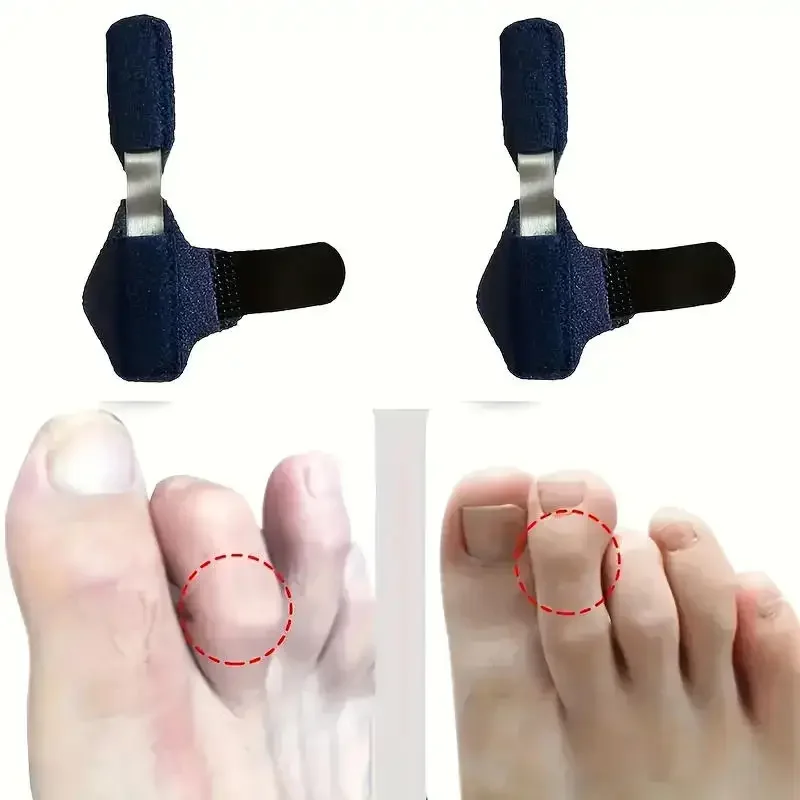 Toe Splint Straightener Hammer Toe Corrector Crooked Claw Stabilizer Support Brace Wrap Pain Relief Kids Adults