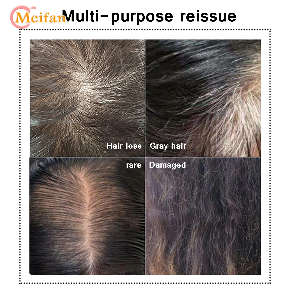MEIFAN stv Szintetikus csipesz Be haja kiterjesztése Cilinder Összesít Térfogat Közép Rész Láthatatlan Bekapcsolás Vendéghaj számára Burkolat Fehérítőszer haja