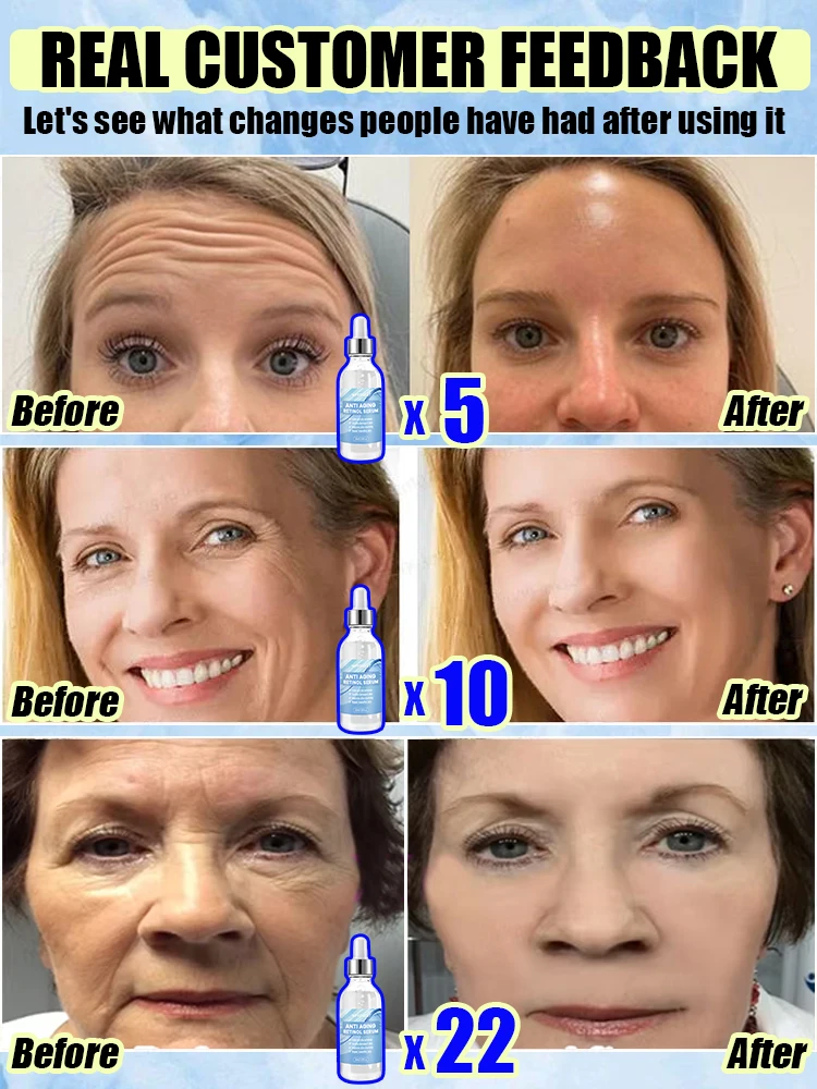 Return youth eliminate signs aging tighten skin for anti aging skin care