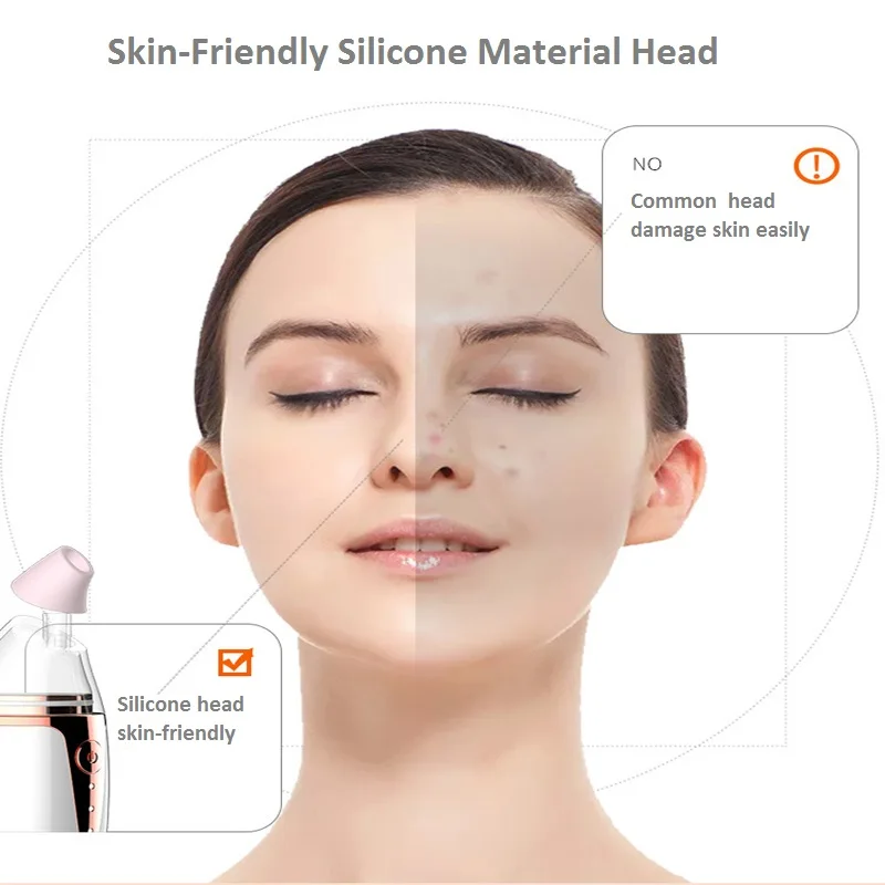 Electric Blackhead Remover - Image 3