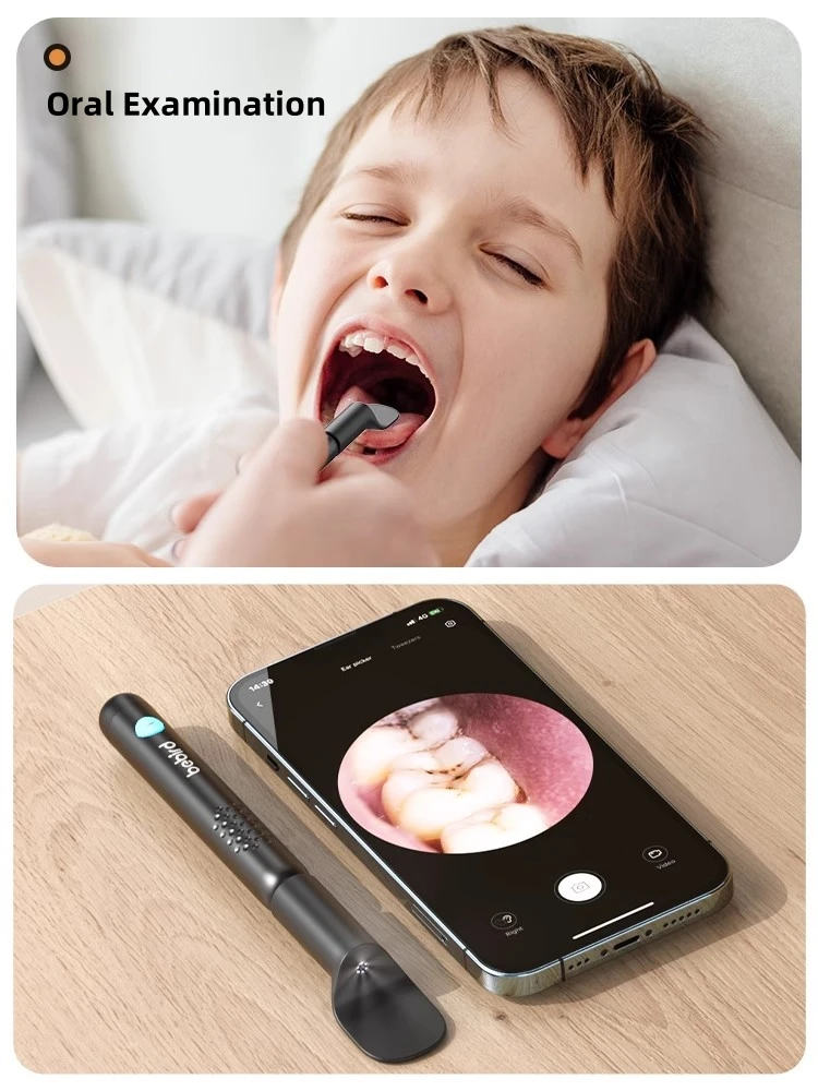 Description Picture 3 of itemBebird R3 Ultra Ear Cleaner Minifit Ear Wax Removal Tool Mini Nose Mouse Examine HD Camera Earpick Otoscope Personal Health Care