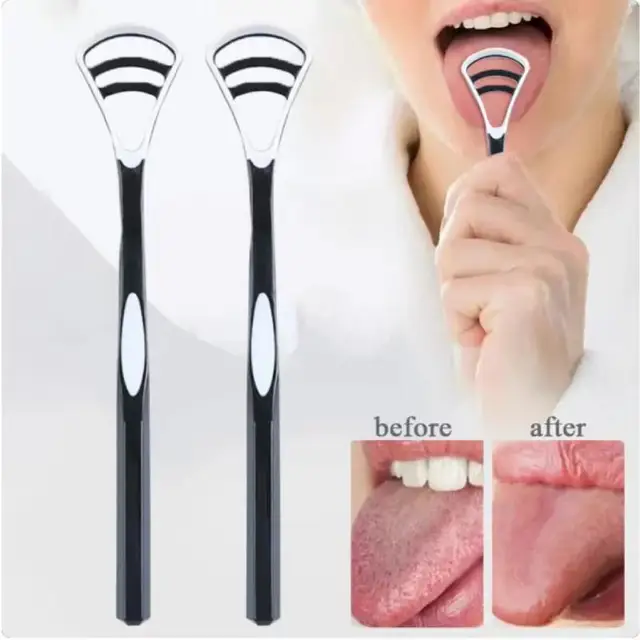Tongue Scraper, Tongue Coating Cleaner, Tongue Scraper To Eliminate Bad Breath, Thick And White Tongue Coating, Oral Care 1