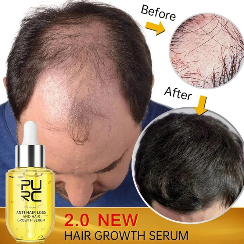 

PURC Fast Hair Growth for Men Women Ginger Grow Hair Oil Care Anti Hair Loss Scalp Treatment Serum Products Beauty Health 2023