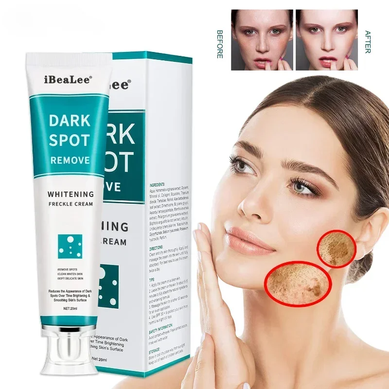 Crema blanqueadora para pecas, elimina el Melasma, manchas oscuras, aclara la melanina, hidratante, ilumina la cara, cuidado de la piel, 20ml