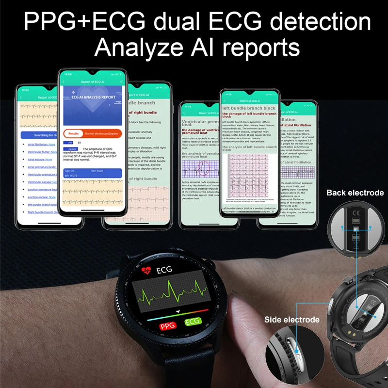 Setup for pressure film measurements of distal radioulnar joint... |  Download Scientific Diagram