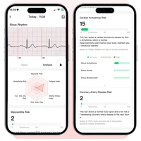 2026 New Nursing Grade Health Analysis SmartWatch ECG+PPG Blood pressure lipids Uric acid Wireless Call Smartwatch For Men Women - Image 4