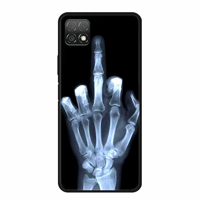 Marble Soft TPU Silicone Phone Case with Fashionable Cartoon Design
