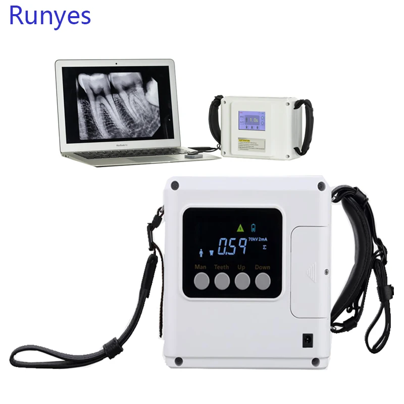 Runyes Protable High Frequency Dental Xray Machine Digital Wireless X Ray Machine RVG Sensor