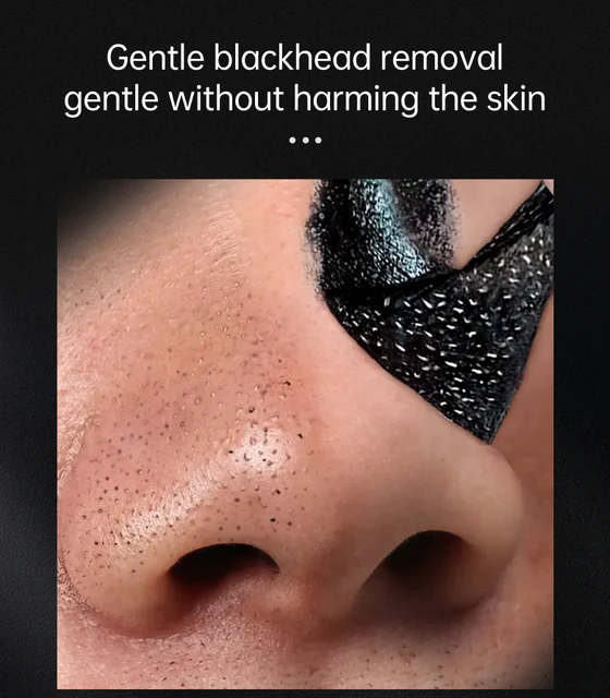 blackhead removal mask diy