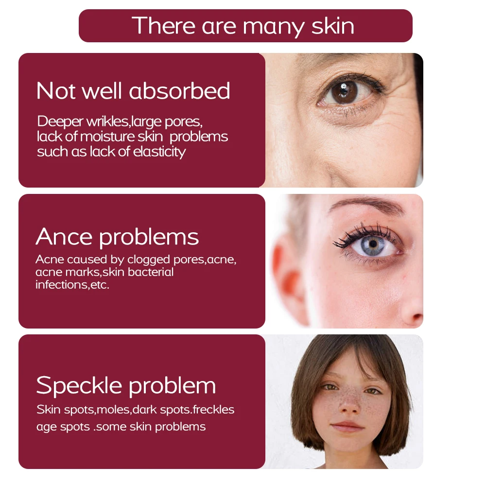 ●多機能レーザープラズマペン まぶたリフティングペンタトゥー ほくろ除去顔 そばかすダークスポットリムーバーツール いぼ除去機 プラズマペンまぶたリフティングペンレーザープラズマリニアプラズマペンタトゥーそばかすダークスポットリムーバーいぼ除去美容サロンマシン -  AliExpress