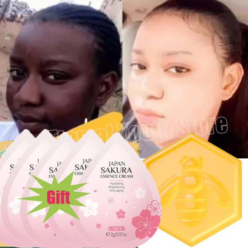Body Whitening Soap Deep Clean Skin Chicken Skin Removal Soap Armpit Underarm Knees Bleaching Body Brighten White Care Products