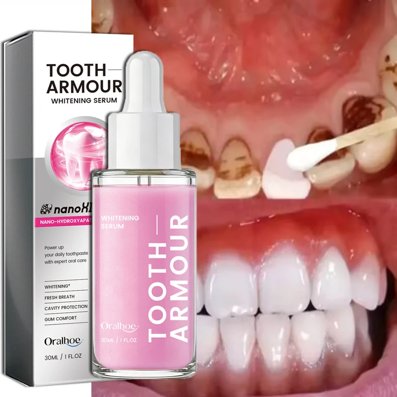 Siero Sbiancante per Denti, Rimuove le Macchie di Placca, Pulizia Profonda, Essenza per Igiene Orale, Ripristino dello Smalto, Alito Fresco, Cura per Denti Luminosi - immagine 3