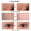 Ultrasonic Face Scrubber Facial Peeling Skin Scrubber Deep Facial Cleaning Spatula Acne Pore Ultrasonic Scrubber Facial Cleanser 6