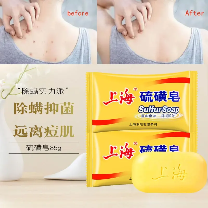 

85g Shanghai Sulfur Soap Oil-Control Acne Treatment Psoriasis Seborrhea Eczema Anti Fungus Bath Healthy Soaps Eczema