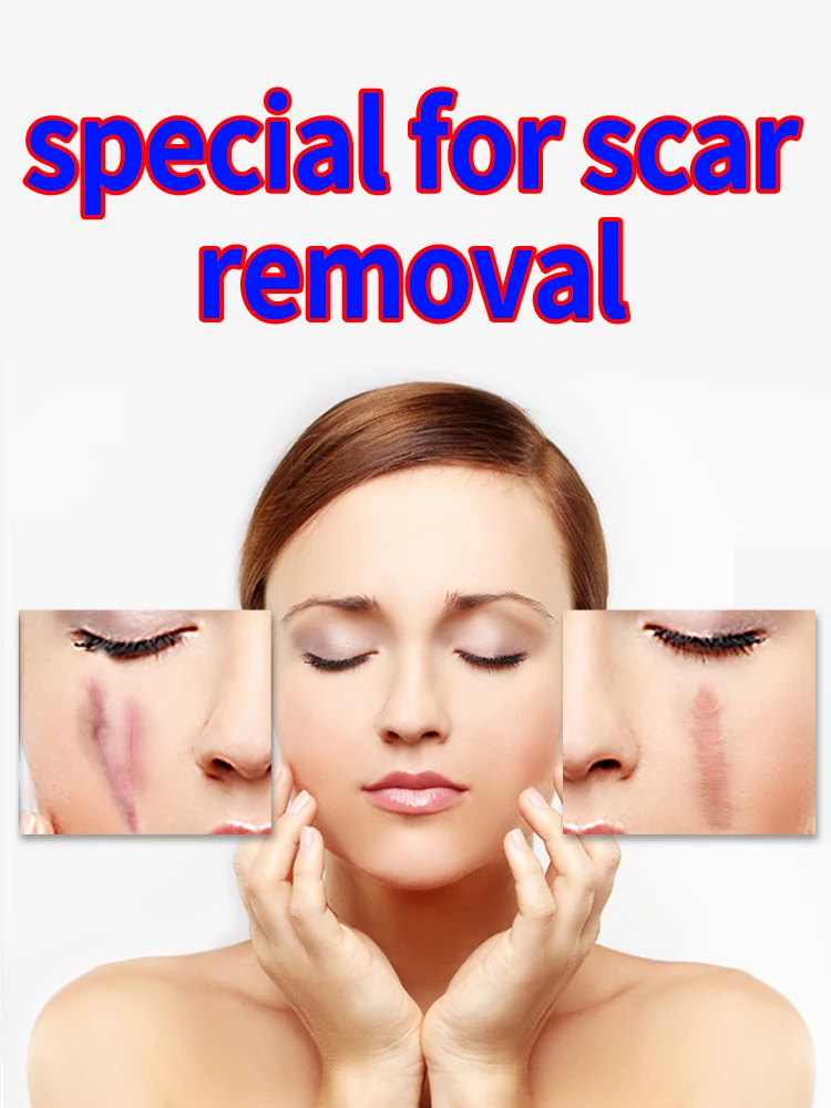 30 Day Scar Removal Medical Grade Scar Cream For Face Body, Surgery, C