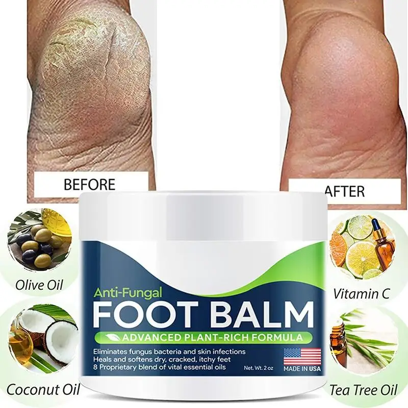 Foot Cure All-Natural Plant Foot Balm – Moisturizing Foot Care Cream for Dry Skin