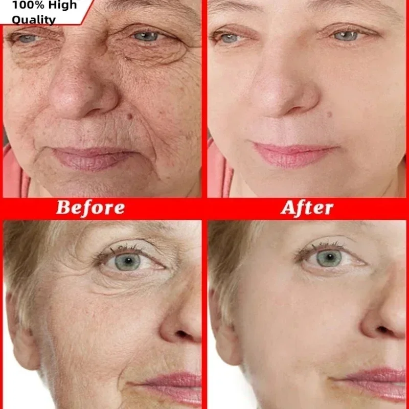 Facial Serum 20pcs Hyaluronic Acid Capsules Serum Face Fine Line Repair Spot Remove Whiten Anti-Wrinkle Ageless Firm Skin Care Cosmetics facial serum