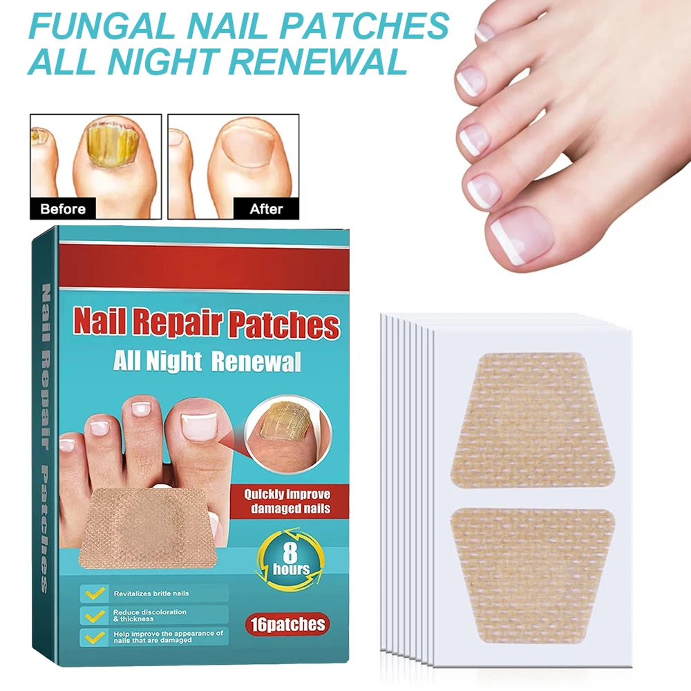 Anti Infection Nail Patch Onychomycosis Removal Grey Nail Repair Remove Fungus Ingrown Toenail Care Paronychia Treatment Sticker toenail fungus patch