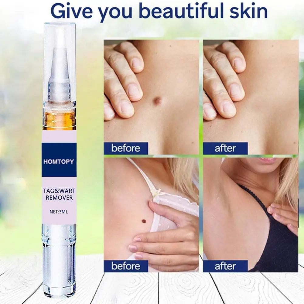 

1pc Wart Remover Essential Oil Treatment Neck Skin Mole Sarcoma Label Corn Antibacterial Wart Genital Wart Removal Gel Care