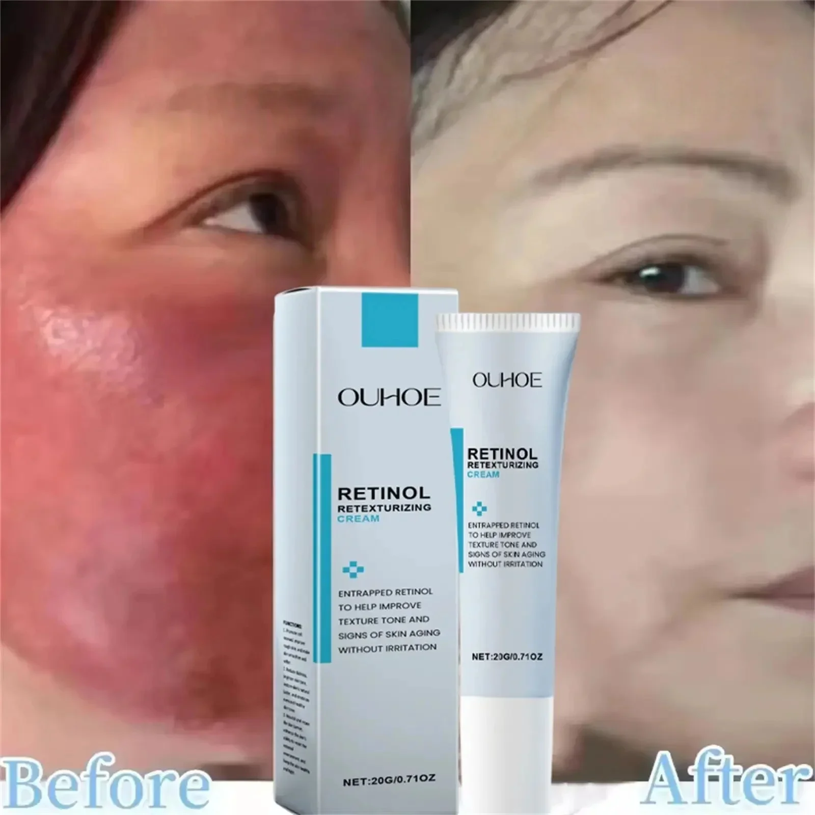 Facial Redness Relief Moisturizing Cream