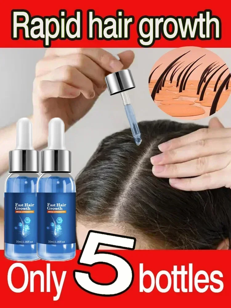 

Effective Fast Hair Growth Oil Baldness Repair Hereditary Postpartum Seborrheic Anti Loss