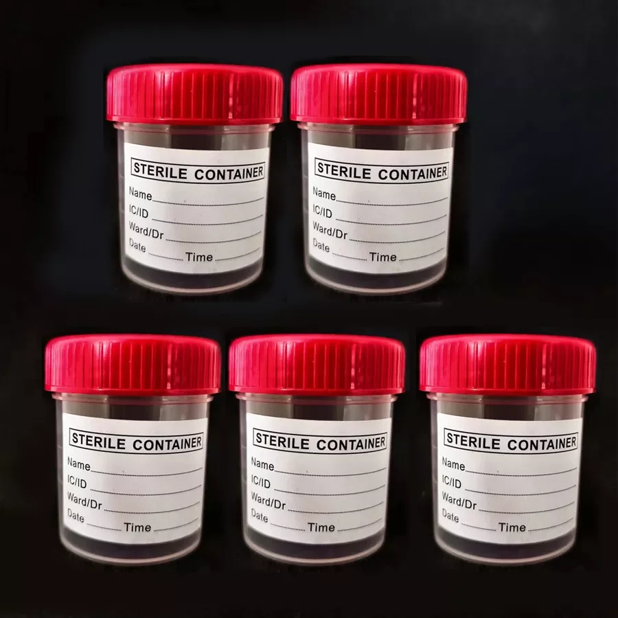 5pcs 60ML Urine Collection Specimen Bottle Sample Top Cup Pot Container Disposable Sampling Sputum Cup with Lid ,scale, Label