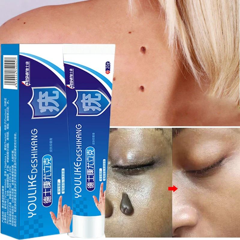 

7 Days Painless Skin Tags Remover Serum Removal Dark Spot Warts Treatment Mole Skin Acne Freckle Essential Oil Beauty Health 25g