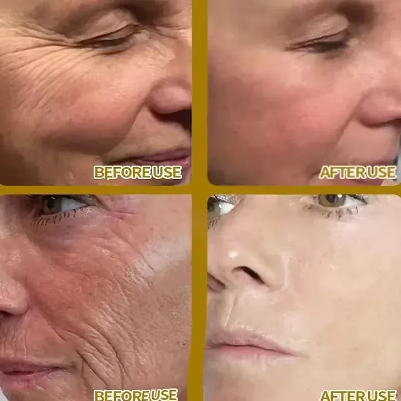 سيروم كوري سيول 1988 الجينسنغ الأسود 2% الريتينال...