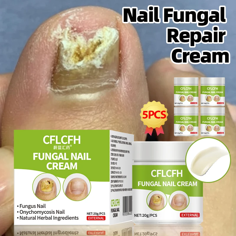 

Fungal Nail Treatment Cream Onychomycosis Repair Paronychia Anti Infection Toe Fungus Removal Nail Correction Gel Foot Care