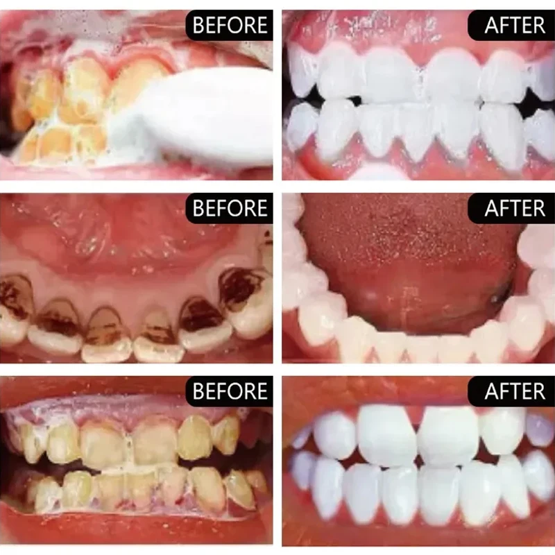 Antibacterial Whiten Toothpaste Cleaning Teethrefreshing Mouth Mint Fresh Mouth Remove Plaque Smoke Coffee Tea Stains Clean Oral