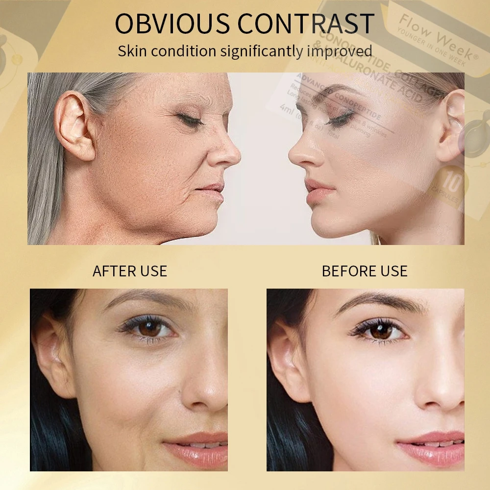 Wrinkle Patches Reusable, Anti Wrinkle Facial Patches for Face Overnight to Lifting Firming Smooth Fine Lines Reducing Wrinkles - Image 4