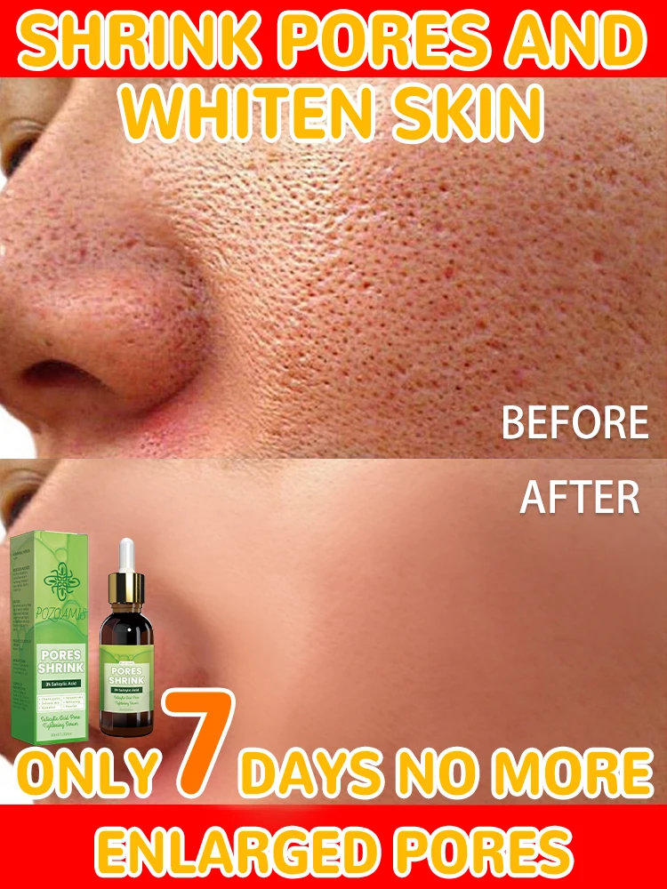 

Попрощайтесь с расширенными порами