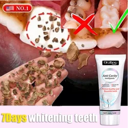 Useful Toothpaste Prevent And Repair Tooth Decay Remove Plaque Relieve Periodontitis Toothache Freshen  Whiten Teeth Bad Breath
