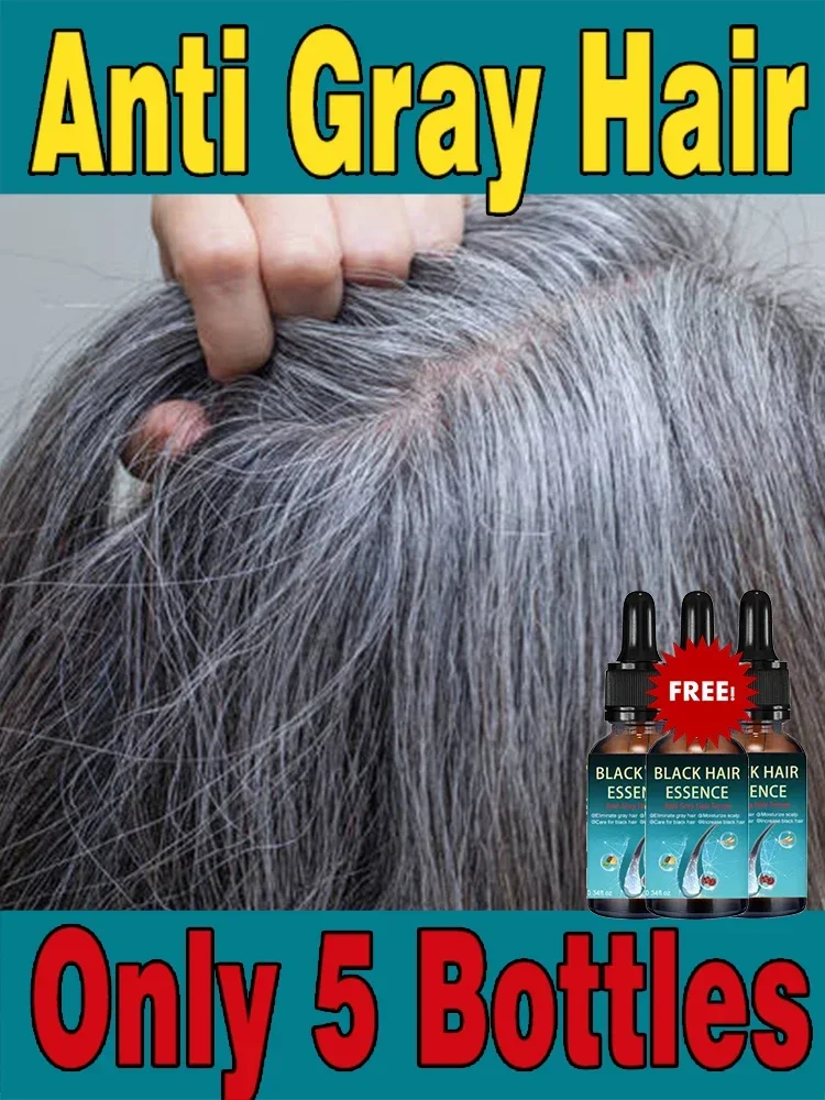 

Gray White Hair Treatment Serum White To Black Natural Color Repair Nourish Anti Loss Hair Care for Men Women Liquid
