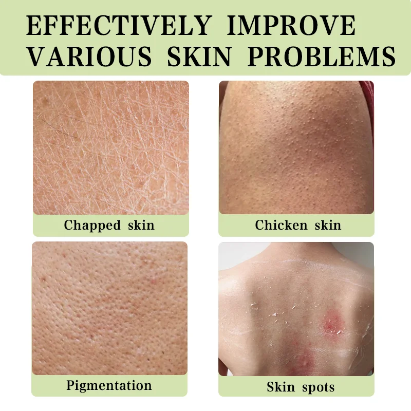 Body Scrub Coconut Exfoliator Body Scrub Smooth Skin Improve Chicken Skin Whitening Gentle Moisturizing 100g Deep Cleaning Cracked
