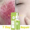 7 Day Repair Redness Serum Sooth Itching Sensitive Skin Improve Rosacea Shrink Pore Smooth Nourish Facial Skin Korean Cosmetics 1