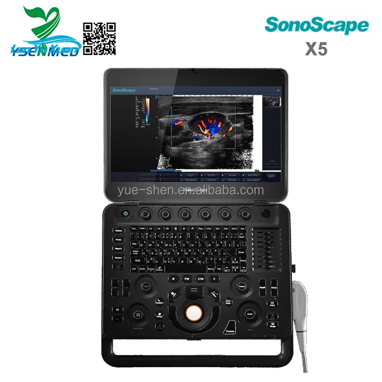 Рисунок 4 - Заводская цена, портативная 3D