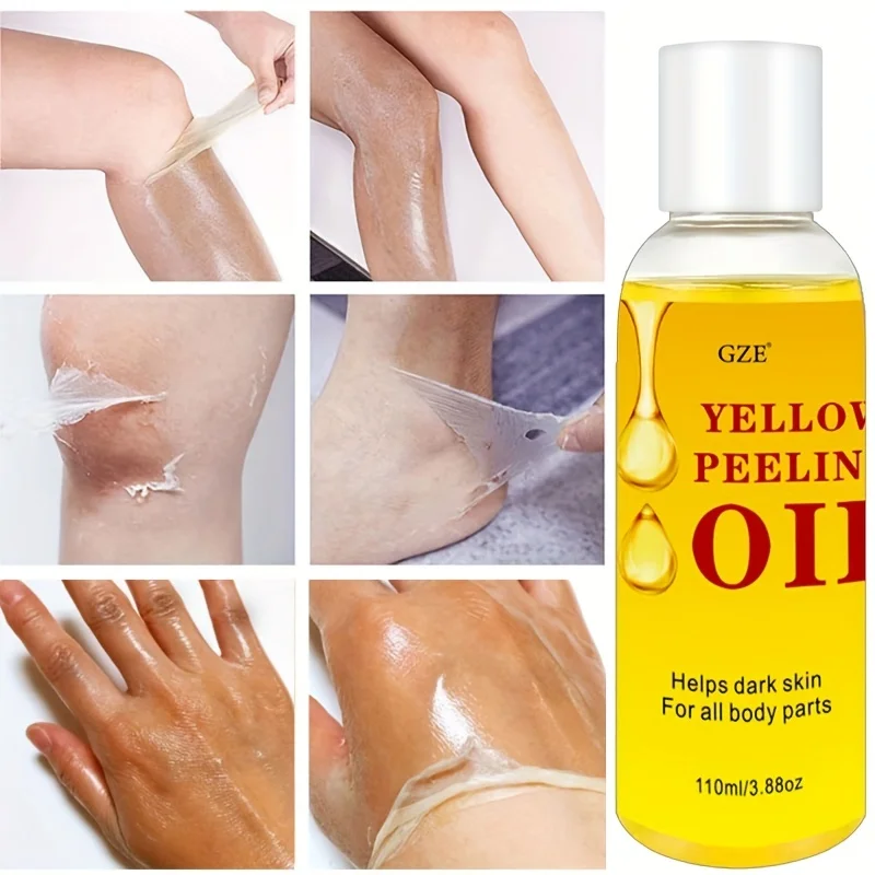 Huile Peeling Jaune Super Forte - 110 Ml, Pour Taches Et Imperfections De La Peau