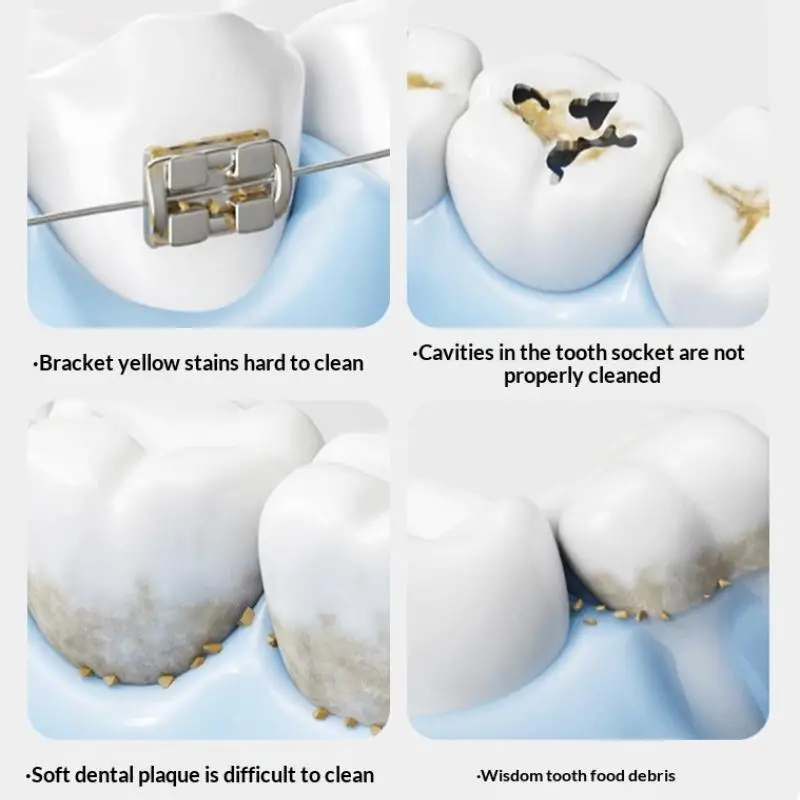 1/2Pcs Small Head Single Bundle Interdental Brush Angle Floss Teeth Cleaning Toothbrush Soft Hair Adult Oral Care Tools