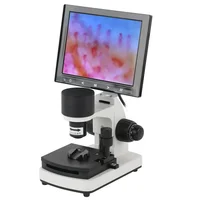 Profesional Nailfold Capillary Microcirculation HD 1000X Microscope Blood Observer Integrated Machine Color LCD Displayer 1