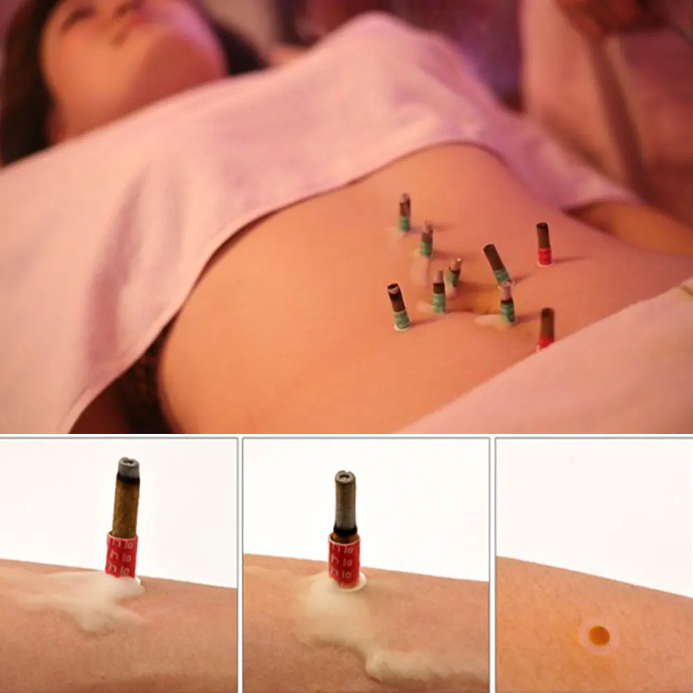 180Pcs Mini Moxa Tubes Self Sticks Chinese Micro Smoke Moxibustion Stickers Chinese Massager Therapy Health Care