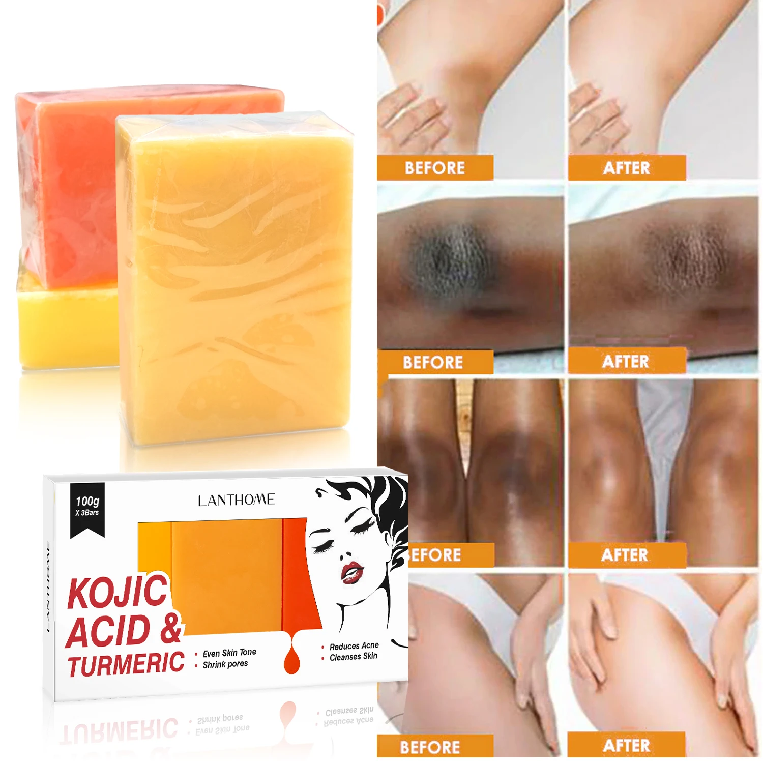 Turmeric Soap Kojic Acid Soap Body Whitening Soap 3pcs/set